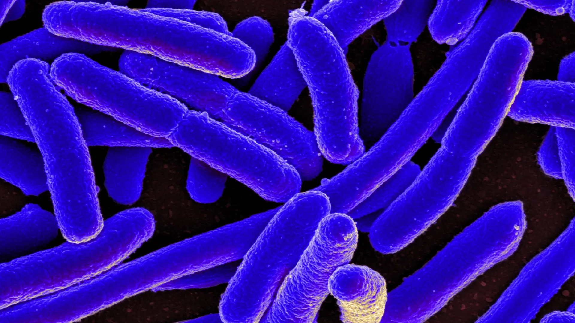 Publix GreenWise Blueberries E. coli Lawyer