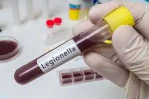 Hand of researcher holds test tube with blood for Legionella tes